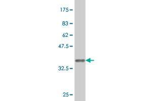 Western Blot detection against Immunogen (37. (FGFR1 antibody  (AA 303-408))