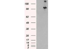 Western Blotting (WB) image for anti-Tuberous Sclerosis 1 (TSC1) (C-Term) antibody (ABIN2466406) (TSC1 antibody  (C-Term))