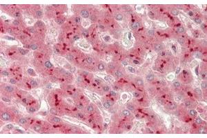 Immunohistochemistry (IHC) image for anti-ADAM Metallopeptidase Domain 10 (ADAM10) (AA 420-641) antibody (ABIN7432559)