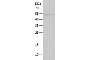 Western Blotting (WB) image for Insulin Receptor (INSR) (AA 1023-1298) protein (His-IF2DI Tag) (ABIN7123446) (Insulin Receptor Protein (INSR) (AA 1023-1298) (His-IF2DI Tag))
