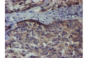 Image no. 3 for anti-Zinc Finger Protein 365 (ZNF365) (AA 108-407) antibody (ABIN1490829) (ZNF365 antibody  (AA 108-407))