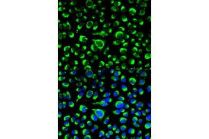 Immunofluorescence analysis of HeLa cell using P4HB antibody. (P4HB antibody  (AA 329-508))
