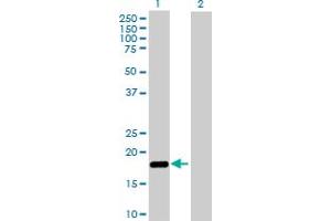 Western Blot analysis of NUDT2 expression in transfected 293T cell line by NUDT2 MaxPab polyclonal antibody. (NUDT2 antibody  (AA 1-147))
