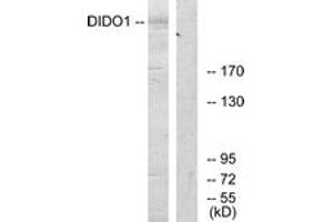 Western blot analysis of extracts from 293 cells, using DIDO1 Antibody. (DIDO1 antibody  (AA 161-210))