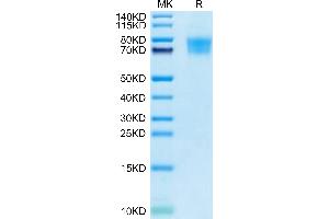 Cynomolgus TIM4 on Tris-Bis PAGE under reduced condition. (TIMD4 Protein (AA 25-305) (His tag))