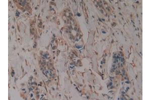 DAB staining on IHC-P; Samples: Human Stomach Tissue)