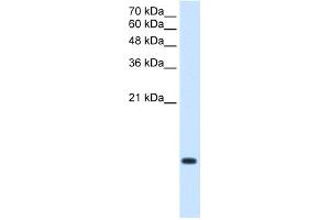 WB Suggested Antibody Titration:  2. (BRK1 antibody  (Middle Region))