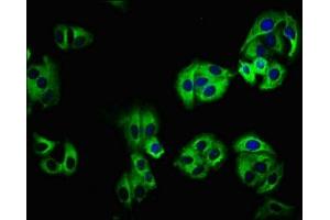 Immunofluorescence staining of HepG2 cells with ABIN7157976 at 1:100, counter-stained with DAPI. (LEMD1 antibody  (AA 44-151))