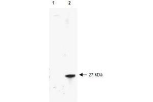 Image no. 1 for anti-Red Fluorescent Protein (RFP) antibody (ABIN401229) (RFP antibody)