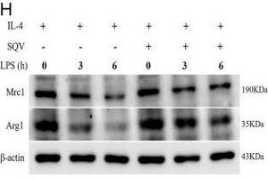 SQV inhibits LPS-mediated proinflammatory state and M1 polarization of RAW 264. (Liver Arginase antibody  (AA 1-322))