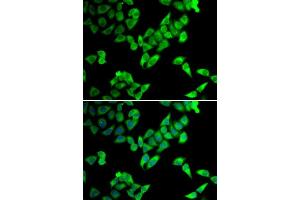 Immunofluorescence analysis of U2OS cells using TRIP10 antibody. (TRIP10 antibody  (AA 246-545))