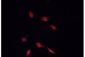 ABIN6269240 staining  A-431 cells by IF/ICC.