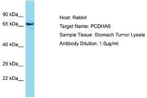 Host: Rabbit Target Name: PCDHA6 Sample Type: Stomach Tumor lysates Antibody Dilution: 1. (PCDHA6 antibody  (N-Term))