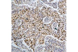 IHC analysis of PHF21A using anti-PHF21A antibody (ABIN6719353). (PHF21A antibody  (AA 1-97))