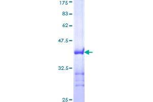 Transportin 1 Protein (TNPO1) (AA 25-141) (GST tag)