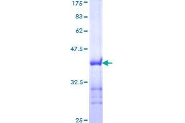 Transportin 1 Protein (TNPO1) (AA 25-141) (GST tag)