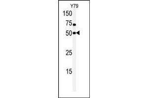 Western blot analysis of anti-hCLK1-C84 Pab in Y79 cell line lysate. (CLK1 antibody  (N-Term))