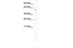 Image no. 1 for anti-Achaete-Scute Complex Homolog 2 (ASCL2) (AA 118-167) antibody (ABIN202132) (ASCL2 antibody  (AA 118-167))