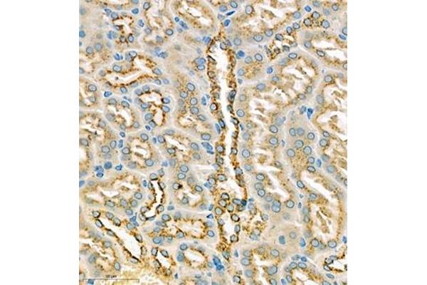 EIF5A2 antibody