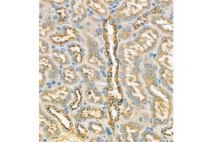 Immunohistochemistry of paraffin embedded mouse kidney using eIF5A2 (ABIN7073893) at dilution of 1:250 (400x lens) (EIF5A2 antibody)