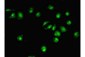 Immunofluorescent analysis of MCF-7 cells using ABIN7150677 at dilution of 1:100 and Alexa Fluor 488-congugated AffiniPure Goat Anti-Rabbit IgG(H+L) (DTWD1 antibody  (AA 1-109))
