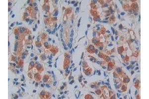 DAB staining on IHC-P; Samples: Human Stomach Tissue (IRAK2 antibody  (AA 235-521))