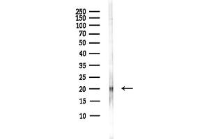 anti-Josephin Domain Containing 2 (JOSD2) antibody
