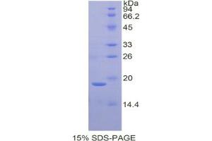 SDS-PAGE analysis of Rat Galectin 7 Protein. (LGALS7 Protein)