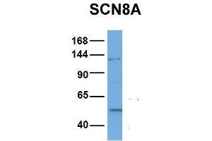 Host:  Rabbit  Target Name:  SCN8A  Sample Type:  NCI-H226  Antibody Dilution:  1. (SCN8A antibody  (Middle Region))