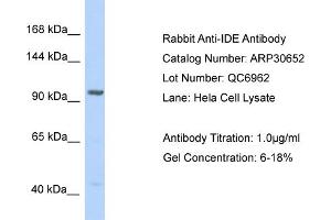 WB Suggested Anti-IDE Antibody   Titration: 1. (IDE antibody  (N-Term))