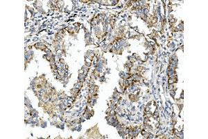 IHC analysis of Integrin beta 4/ITGB4 using anti-Integrin beta 4/ITGB4 antibody (ABIN7601135).