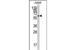 Western blot analysis of CYP26A1 polyclonal antibody  in Jurkat cell line lysates (35 ug/lane). (CYP26A1 antibody  (Internal Region))
