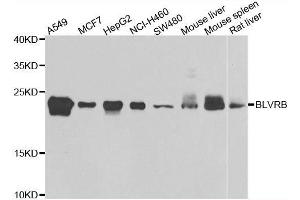Western blot analysis of extracts of various cell lines, using BLVRB antibody. (BLVRB antibody  (AA 1-206))
