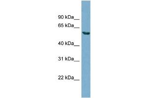 WB Suggested Anti-HHAT  Antibody Titration: 0. (HHAT antibody  (N-Term))