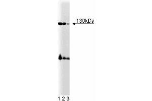 Western blot analysis of BMPR-II on mouse cerebrum lysate. (BMPR2 antibody  (AA 803-996))