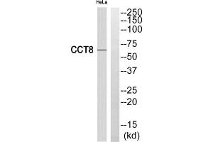 Western blot analysis of extracts from HeLa cells, using CCT8 antibody. (CCT8 antibody  (Internal Region))