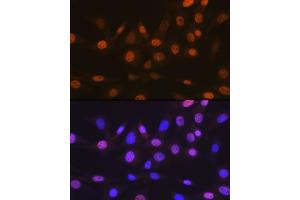 Immunofluorescence analysis of NIH-3T3 cells using T Rabbit mAb (ABIN7270729) at dilution of 1:100 (40x lens).