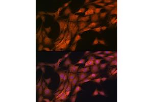 Immunofluorescence analysis of C6 cells using FKBP38/FKBP8 Rabbit mAb (ABIN7267214) at dilution of 1:100 (40x lens). (FKBP8 antibody)