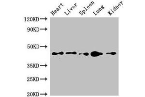 Western Blot Positive WB detected in: Mouse heart tissue, Mouse liver tissue, Mouse spleen tissue, Mouse lung tissue, Mouse kidney tissue All lanes: CD209 antibody at 4 μg/mL Secondary Goat polyclonal to rabbit IgG at 1/50000 dilution Predicted band size: 46, 36, 19, 44, 42, 31, 5, 38, 34 kDa Observed band size: 46 kDa (ITGB1 antibody  (AA 297-380))