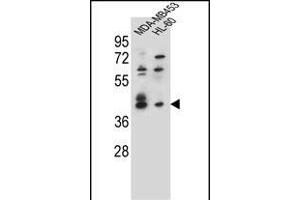 SOX3 Antibody (Center) (ABIN655392 and ABIN2844940) western blot analysis in MDA-M,HL-60 cell line lysates (35 μg/lane). (SOX3 antibody  (AA 166-196))