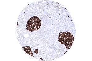 Pancreas A strong synaptophysin immunostaining is seen in islet cells of Langerhans (Recombinant Synaptophysin antibody  (AA 274-313))