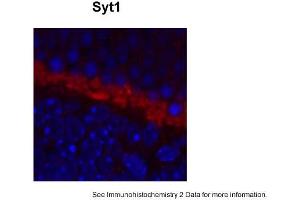 Sample Type: complete mouse retina sectionsRed: PrimaryBlue: DAPIPrimary Dilution: 1:200Secondary Antibody: Goat anti-Rabbit AF568 IgG(H+L)Secondary Dilution: 1:200Image Submitted by: David ZenisekYale University (SYT1 antibody  (Middle Region))