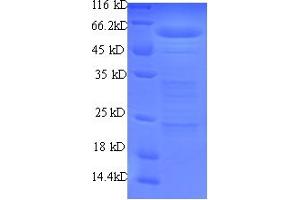 SDS-PAGE (SDS) image for RNA Binding Motif Protein, Y-Linked Family 1 Member A1 (RBMY1A1) (AA 1-459), (partial) protein (His tag) (ABIN5710752) (RBMY1A1 Protein (AA 1-459, partial) (His tag))