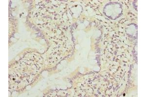 Immunohistochemistry of paraffin-embedded human small intestine tissue using ABIN7173167 at dilution of 1:100 (TMEM243 antibody  (AA 1-31))