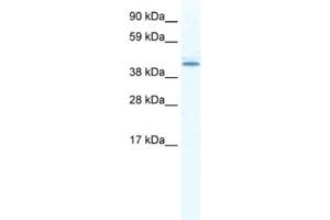 Western Blotting (WB) image for anti-DEAD (Asp-Glu-Ala-Asp) Box Polypeptide 49 (DDX49) antibody (ABIN2461354) (DDX49 antibody)