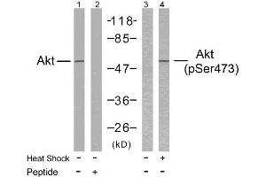Western blot analysis of extracts from HeLa cells using Akt (Ab-473) antibody (E021054, Lane 1 and 2) and Akt (phospho-Ser473) antibody (E011054, Lane 3 and 4).