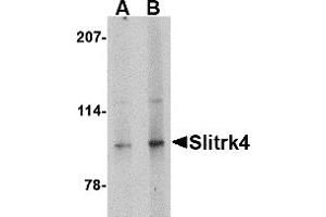 Western Blotting (WB) image for anti-SLIT and NTRK-Like Family, Member 4 (SLITRK4) (C-Term) antibody (ABIN1030684) (SLITRK4 antibody  (C-Term))