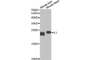Western blot analysis of extracts of various cell lines, using IL3 antibody. (IL-3 antibody)