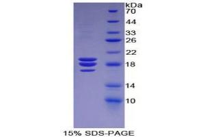 SDS-PAGE (SDS) image for Coagulation Factor VIII (F8) (AA 2191-2337) protein (His tag) (ABIN2120843) (Factor VIII Protein (AA 2191-2337) (His tag))