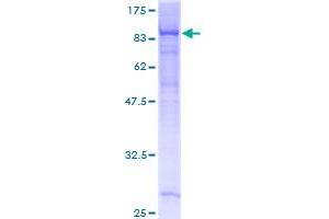 EHD4 Protein (AA 1-541) (GST tag)